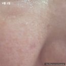 (주)클리어존 | 피캄 홀리바질 버블 딥 마스크 내돈내산 한달사용 후기 사진o, 협찬x