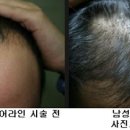 라인헤어 이미지