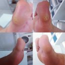 레푸스상무점