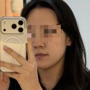 이지이샵 | 엘라스티 포스트랩 병원용 재생크림 후기 시술 후 홈쥬란 케어추천