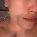 행당로 | 왕십리에스테틱 '정율환골윤곽연구소' 피부 해독 관리 솔직후기