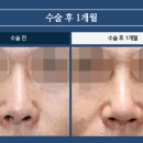 비주