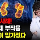 영양제 부작용 실제 사례! 신장이 망가질 때 우리 몸이 보내는 신호. 이런 증상 있으면 비타민 절대 먹지 마세요(비타민D 골다공증, 고 이미지