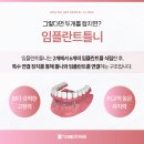 365뿌리치과 티스토리