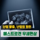 메타바이오 | 수술해도 또 자라나는 자궁근종, 내 자궁이 약해서일까? 장내 미생물이 망가지면 생기는 에스트로겐...