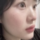 앨브로우 이미지