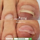 네일존 이미지