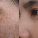 포이즌의원 이미지