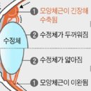 자기 전 스마트폰하면 눈 박살나는 이유 이미지