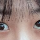 "눈 성형하고 '사시' 됐는데"…병원은 되레 '명예훼손' 협박 이미지