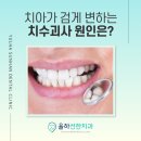 율하선한치과의원 | 율하 치과, 치아가 검게 변하는 치수괴사 원인은?