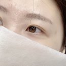 보니떼 이미지