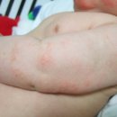 에스알메디 이미지