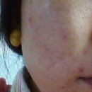 좋은피부 이미지