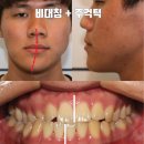 미소외과의원 | 안면비대칭 성형외과 수술, 이거 모르고 결정하면 후회합니다!