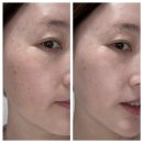 촉촉한 물광피부 만들어주는 노워터 티트리 톤업 선쿠션 사용후기