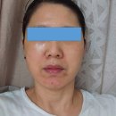 인셀덤(위드퀸) 네이버블로그