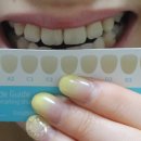 D00336 | [뷰티사이언스] 셀프 치아미백 화이트랩스 후기