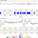 청진 bowel sound, lung sound로 알 수 있는 것!! 이미지