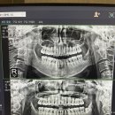 정현치과 이미지