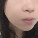 내돈내산 르누베르 파우더 6개월 사용 후기 (톡신님 마켓)