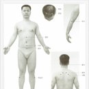 [뜸자리] 중심성망막염(中心性網膜炎) 이미지