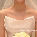 [W관리] 촬영/본식 전에 신부관리로 예쁜 어깨 만들기(비너스웨딩 승모근 주사 리터치 후기.)