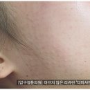 압구정튠의원 이미지