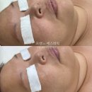 프엔느에스테틱 이미지