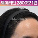 중앙헤어라인 이미지