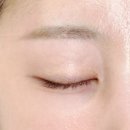 제이유래쉬 | 수원 잔흔제거 제이유래쉬 방문후기! 통증 없고 다음날 출근 가능👌