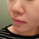 01.실옥사거리 B | 강남역피부관리 에스테틱공간 피지 노폐물 제거 X스케일링 후기