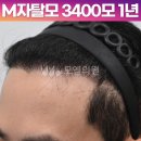 중앙헤어라인 이미지
