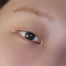 인트로성형외과의원 이미지