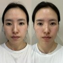 쎄라쥬 11주차 후기 부스터모드 추천 고가 화장품과 함께 사용한 후기