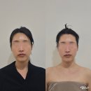 7310 | 압구정피부관리 작은얼굴관리 꽁쌤에스테틱 3V윤곽테라피 예신 솔직후기