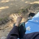 드림정형외과 | 소건막류 수술, 소건막류 수술후기, 발가락 휨 수술, 새끼발가락 수술 후기, 최우진 정형외과 수술후기