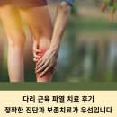 동문외과의원 | 다리 근육 파열 치료 후기 정확한 진단과 보존치료가 우선입니다