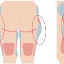 스펀지성형외과의원 네이버블로그