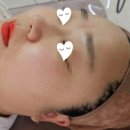 [양주 옥정동] 옥정피부관리 "비비드엘" 기미 잡티/피부톤 확 달라진 후기(+10일기록)✨