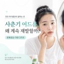 메이피부관리실 | 천안 여드름관리 잘하는 곳 | 사춘기 여드름 계속 재발하는 이유 3가지