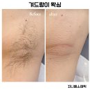 에스테틱 하루