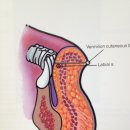 필러&amp;보톡스 주사만으로 '입꼬리 리프팅'이 가능~ 매력적인 'M자형 입술' 만들기~입술필러 쁘띠성형