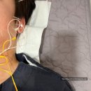 더준한의원 | 명동턱관절치료 내돈내산 후기 2 3회차