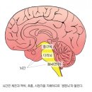 수성메디칼 네이버블로그