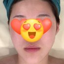 [분당 피부관리]올가드림뷰티 분당무지개마을점에서 피부&amp;복부 디톡스 받은 후기