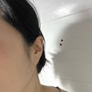 구의로 | 구의스킨플래닝 오소왁싱 :: 스킨플래닝 세라링 업그레이드 엑시드닝 후기