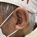 365보청기 | 당진보청기 오티콘 김갑수 365 보청기 착용 후기