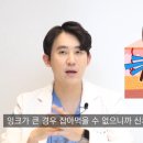 더셀피부과의원 | 문신제거후기 피부과 통해 안전하게