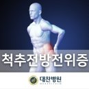 [대찬병원] 3대 척추 질환 중 하나인 척추전방전위증?! 제대로 알아보아요! 이미지